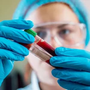 Blood Tests