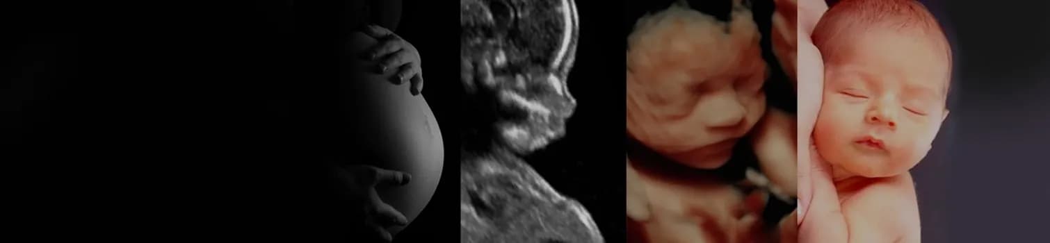 4D Ultrasound Packages