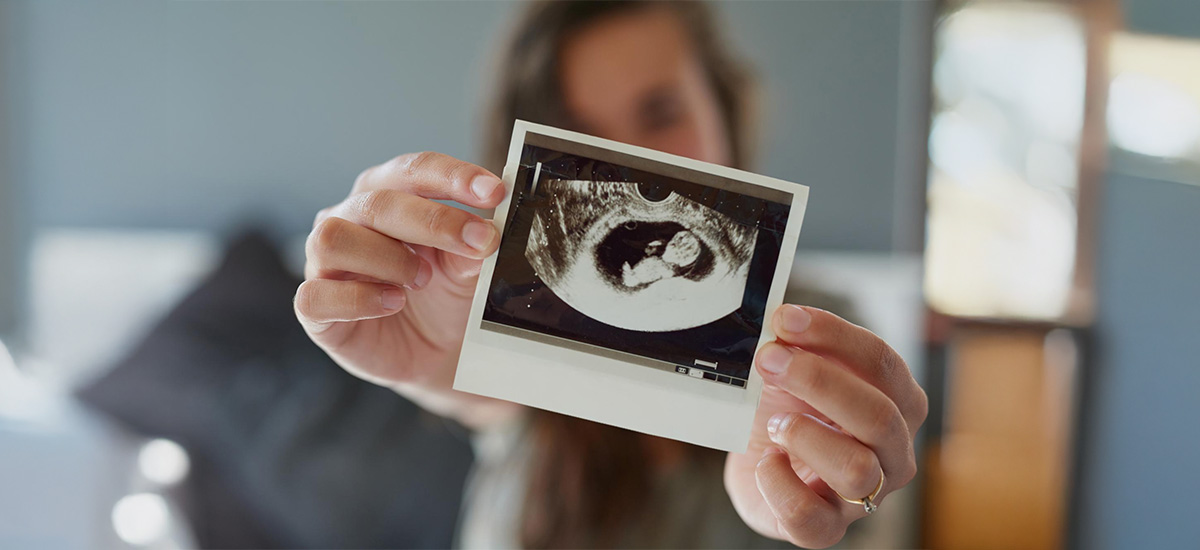 Private pregnancy scan Wolverhampton